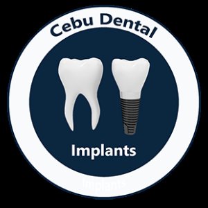 Language : EnglishTopics: Dental ImplantsDental implants are one of the most reliable and long-lasti...