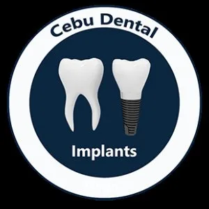 Post by cebudentalimplants