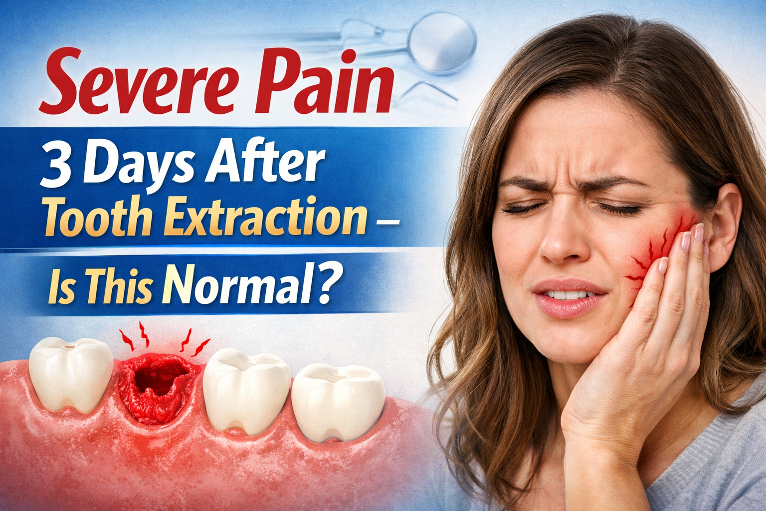 Language : EnglishTopics: ExtractionTooth extraction painSevere Pain 3 Days After Tooth Extraction –...