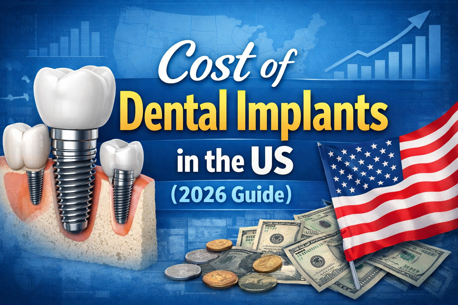 Language : EnglishTopics: Dental ImplantsDental implants are one of the most popular long-term solut...