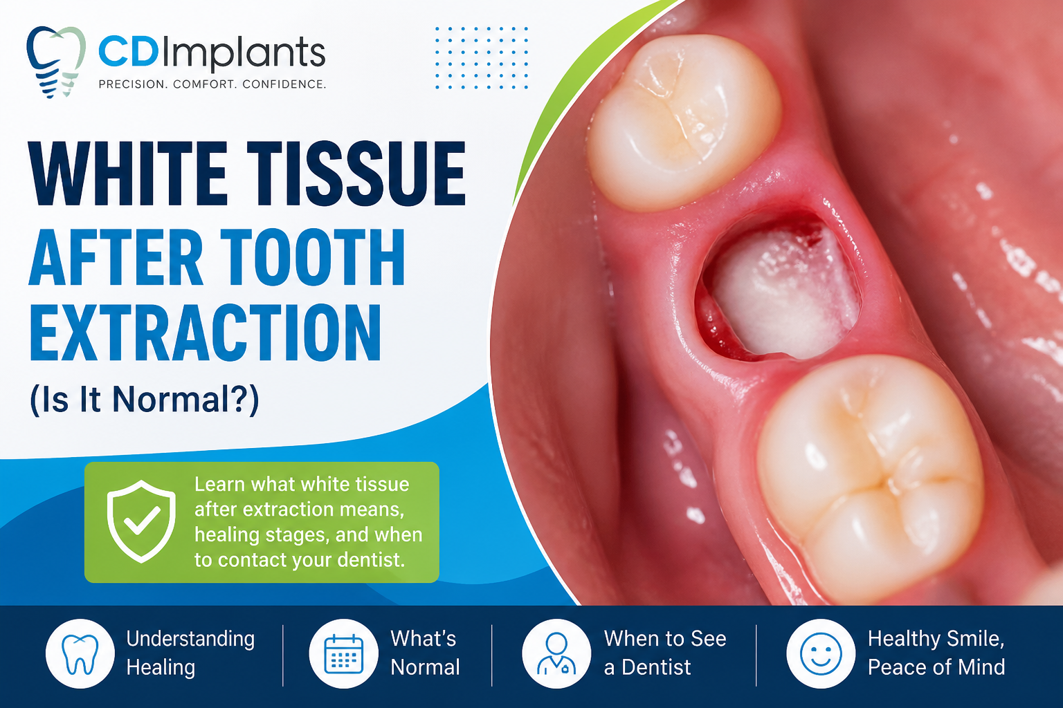 Language : EnglishTopics: ExtractionA clinical guide from a U.S. dental implant & bone graft special...