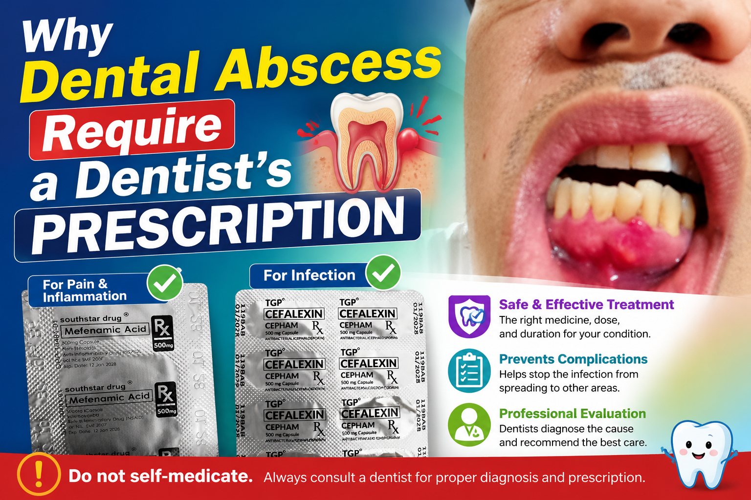 Language : EnglishTopics: Gum abscessA dental abscess is not something patients should self-medicate...