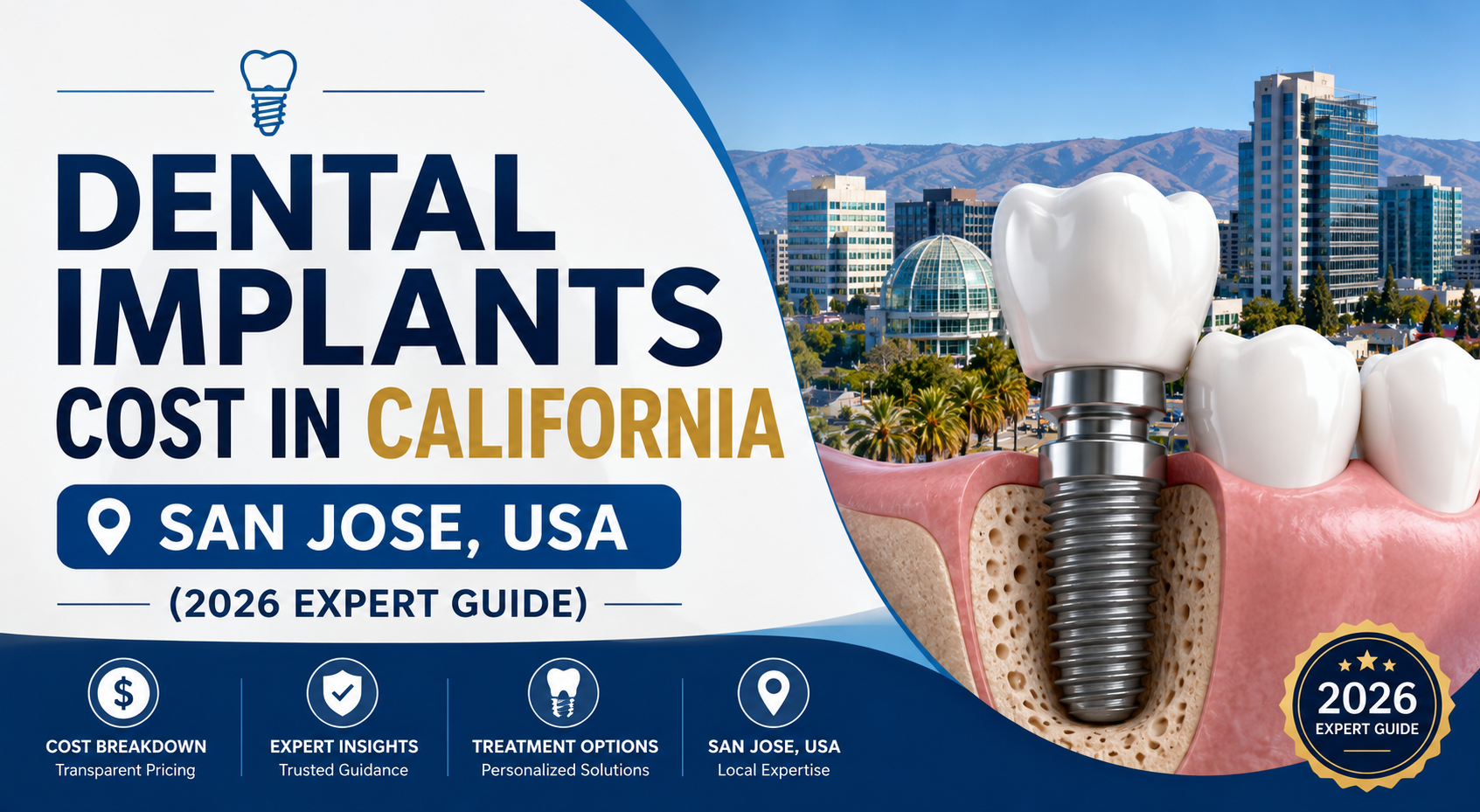 Language : EnglishTopics: Dental ImplantsDental Implants FixingDental implant inflammation (peri-imp...