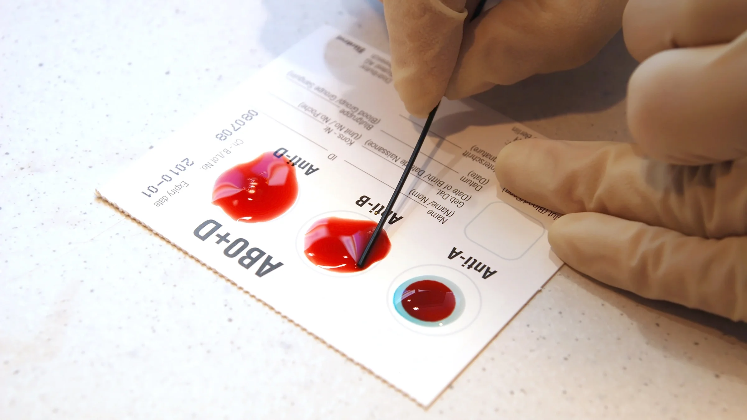 The blood is split into four categories: A, B, AB, and O. Antigens and antibodies can be found in al...