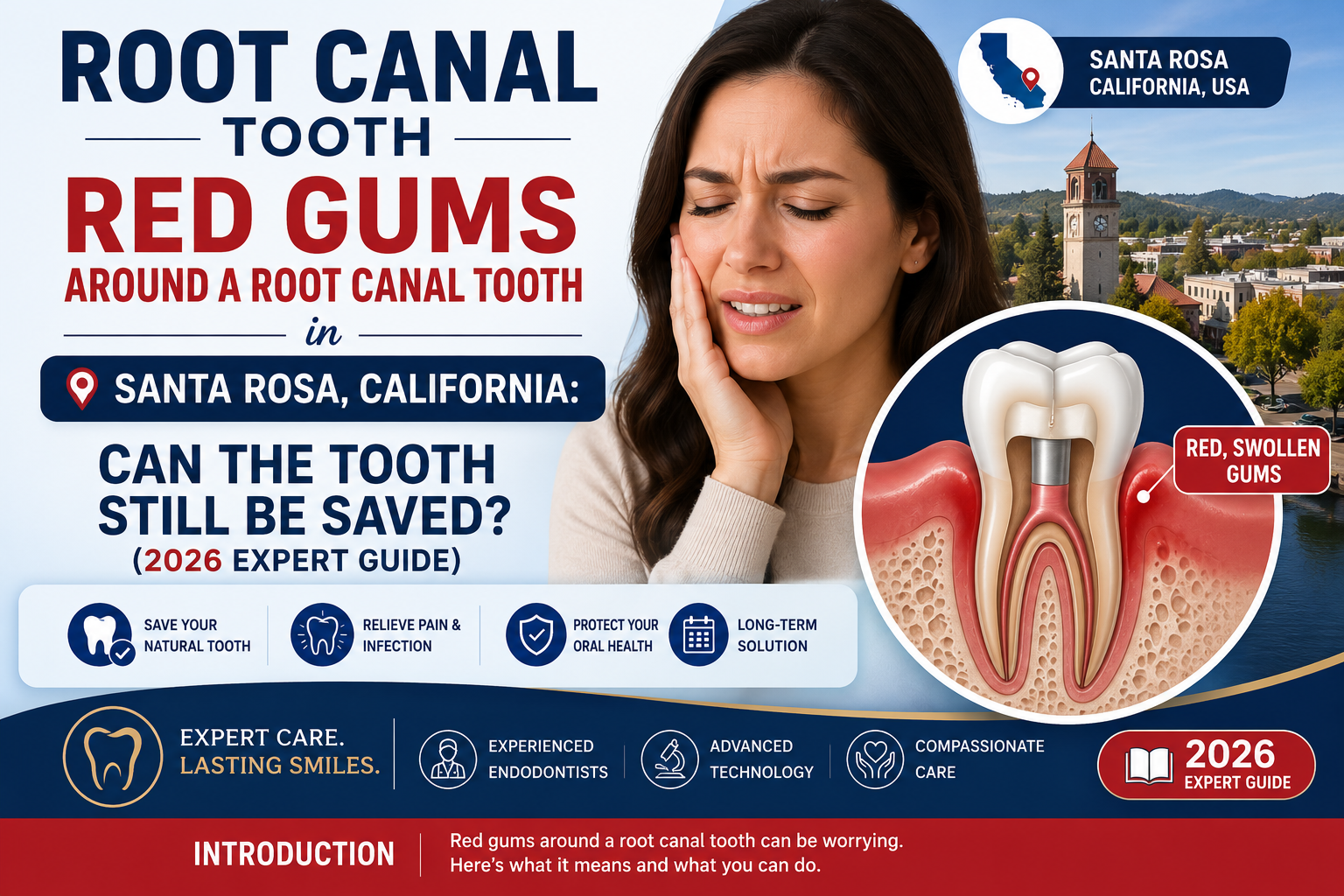 Language : EnglishTopics: Dental ImplantsDental Implants FixingDental implant inflammation (peri-imp...