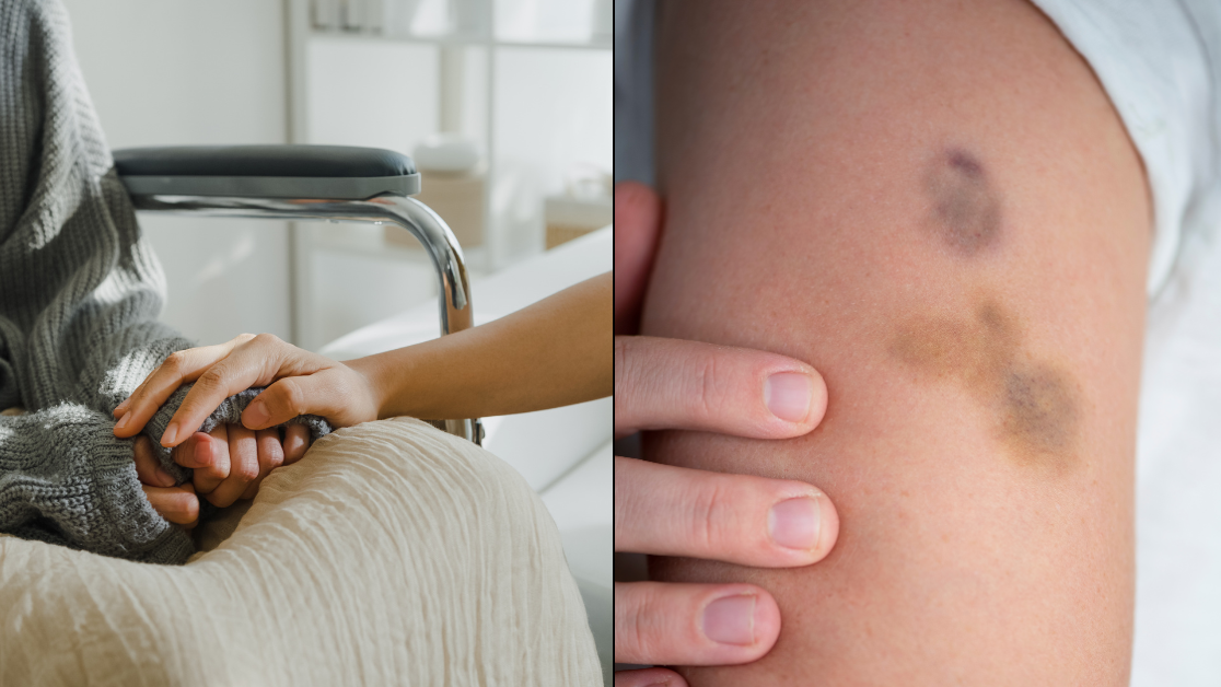 Leukemia a type of cancer that affects the blood and bone marrow often doesn’t scream for attention...