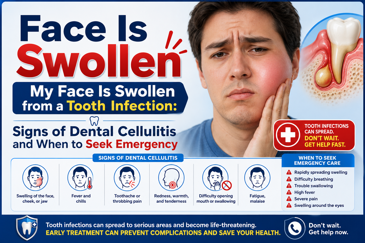 Language : EnglishTopics: Cellulitis
My Face Is Swollen from a Tooth Infection and I Can't Focus on...