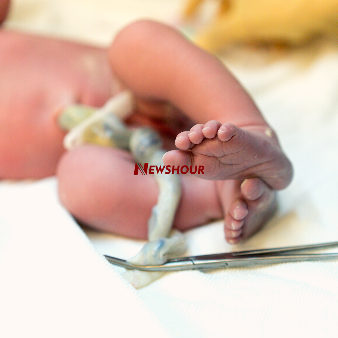 Clamping a baby’s umbilical cord with a peg shortly after birth is a standard practice in modern chi...
