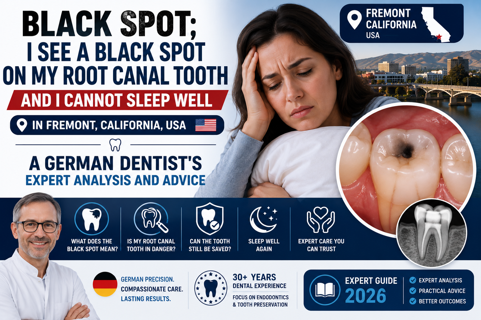 Language : EnglishTopics: Dental ImplantsDental Implants FixingDental implant inflammation (peri-imp...