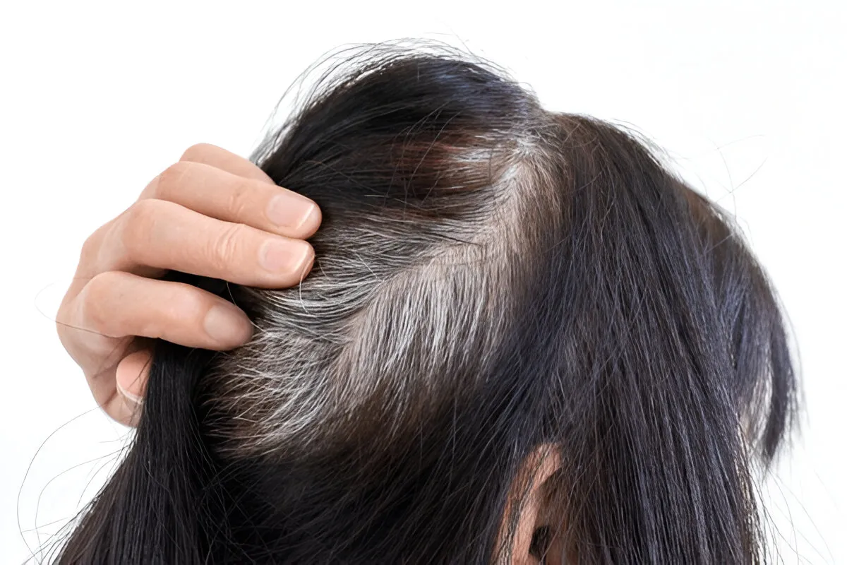 White or premature gray hair is something that many people struggle with as they grow older, and for...