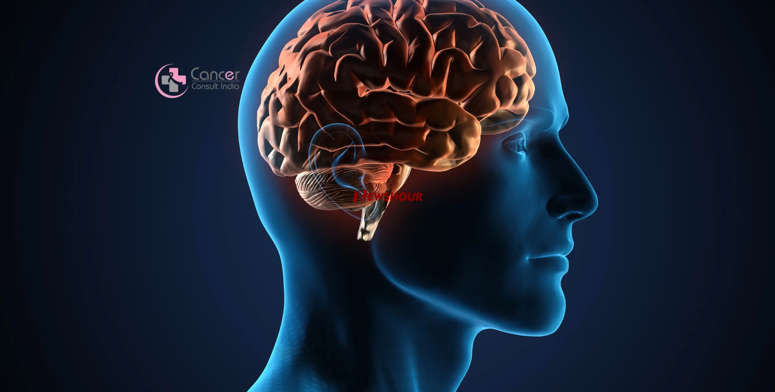 Brain cancer, also referred to as a brain tumor, is caused by excessive cell proliferation in the br...