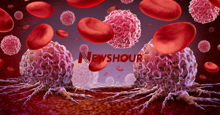Blood cancer, also known as leukemia, lymphoma, or myeloma, affects the blood cells and weakens the...