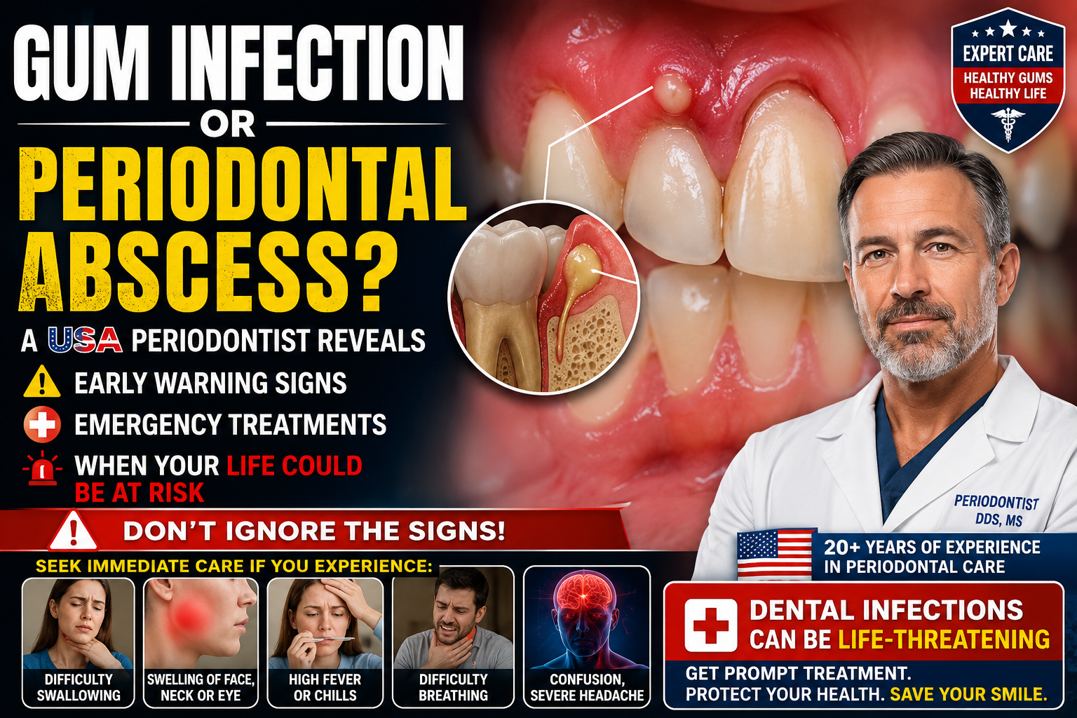 Language : EnglishTopics: Periodontal AbscessGum Infection or Periodontal Abscess? A USA Periodontis...