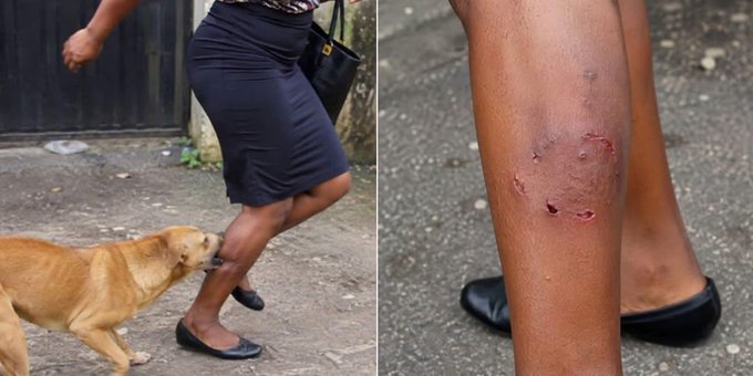 A Nigerian man has cried out online after his wife was reportedly att@cked and bitten by a neighbour...