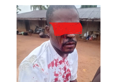 By Jeff Agbodo, Abakaliki
The Ebonyi State Police Command has arrested officers allegedly involved...