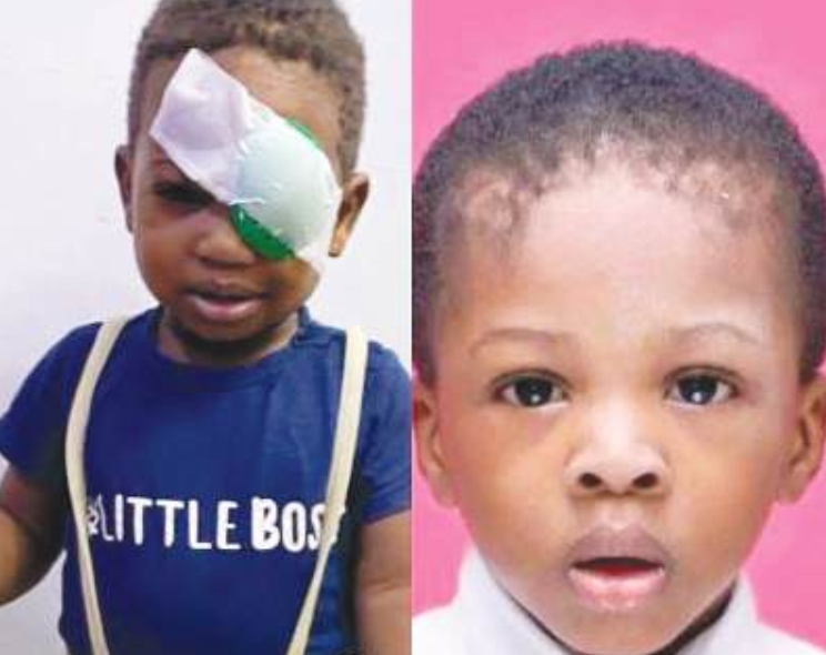 By Ozioruva Aliu
For the past three years, the family of Fidelis Omhonria, from Ubiaja in Esan Sout...