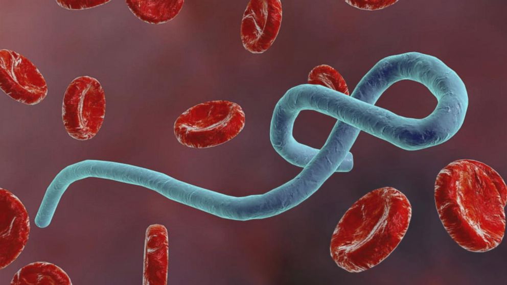 The deadly Ebola outbreak in the Democratic Republic of Congo threatens tens of thousands of jobs an...