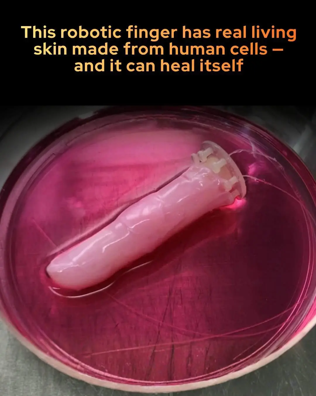 Scientists have successfully grown living human skin around a robotic finger, giving it the ability...