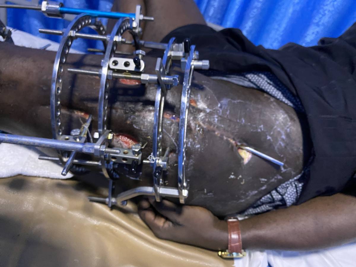 Several attempts have been made including forwarding of an official Report to the Police Headquarte...
