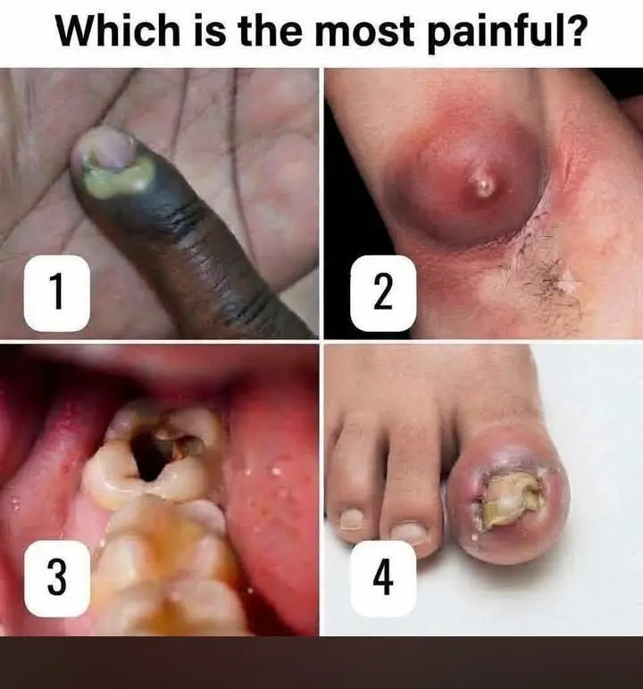 Which one is most painful??
#LekeeLekee #Trending #Viral