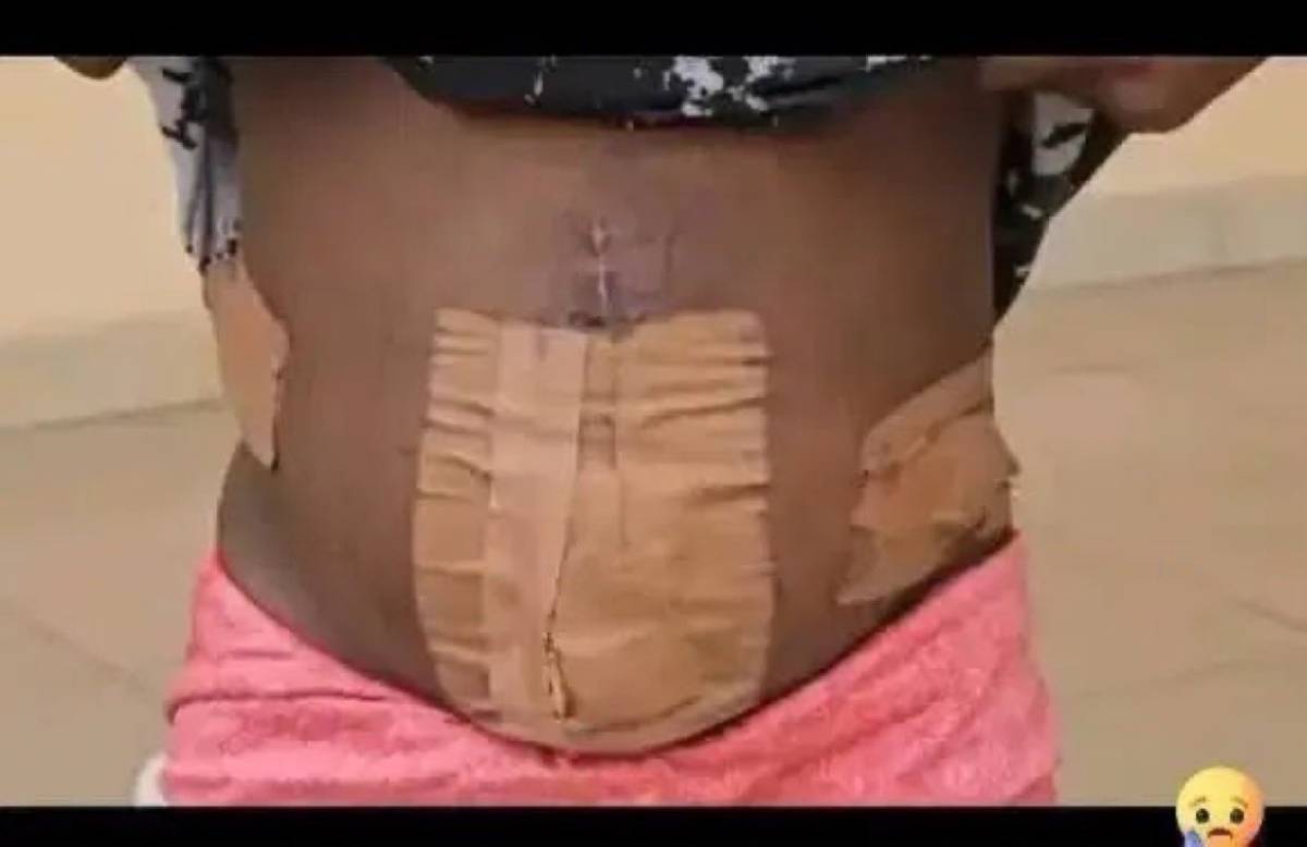 19-year-old girl from Delta State, Nigeria trafficked to Ivory Coast for prostitution loses womb