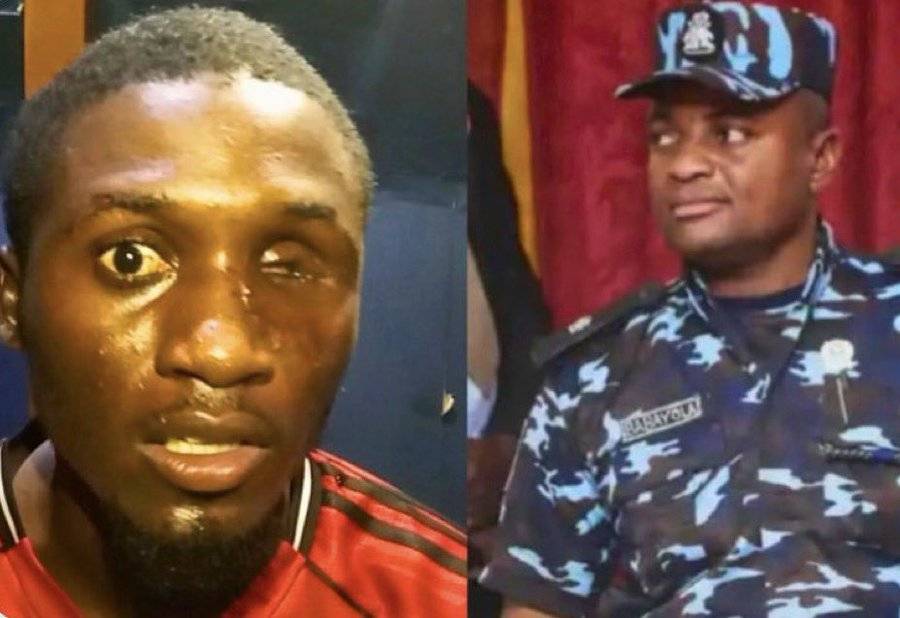 An Abuja barber sues Nigeria Police and Bwari DPO for ₦1 billion after allegedly losing an eye to a...