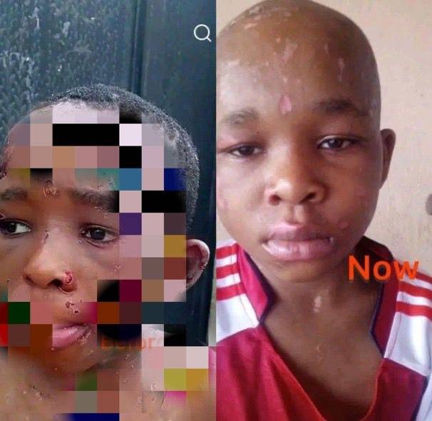 new photograph circulating online highlights the visible physical recovery of a 10-year-old boy who...