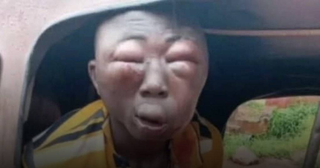 Young Man Confirmed Innocent After he was beaten Over False Theft Allegation in Anambra