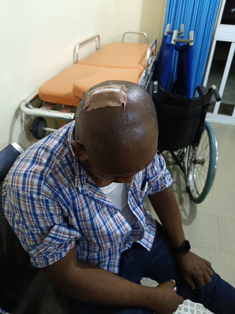 Several officials of the Abuja Electricity Distribution Company (AEDC) Plc were attacked and badly i...