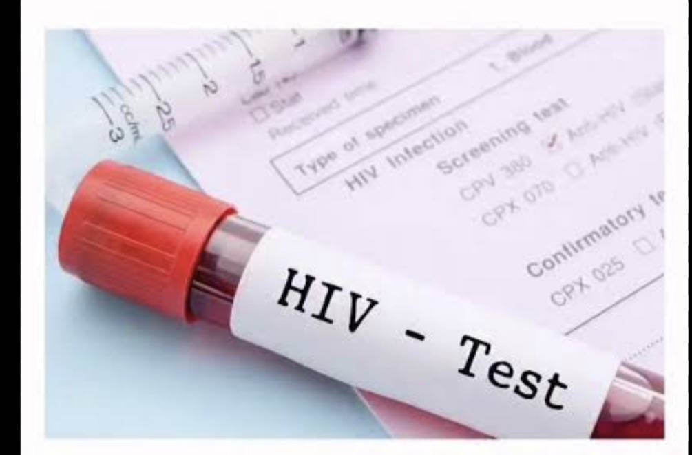 Lagos records the highest absolute number of HIV cases in Nigeria, with over 10,000 new infections i...