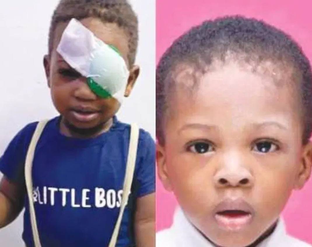 The Parents of slain toddler seek compensation as survivor brother, 4, loses an eye