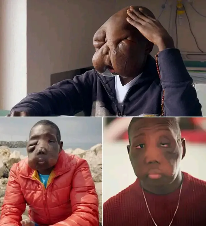 While people avoided Kambou Sie because they feared his illness was contagious, his father kept comi...