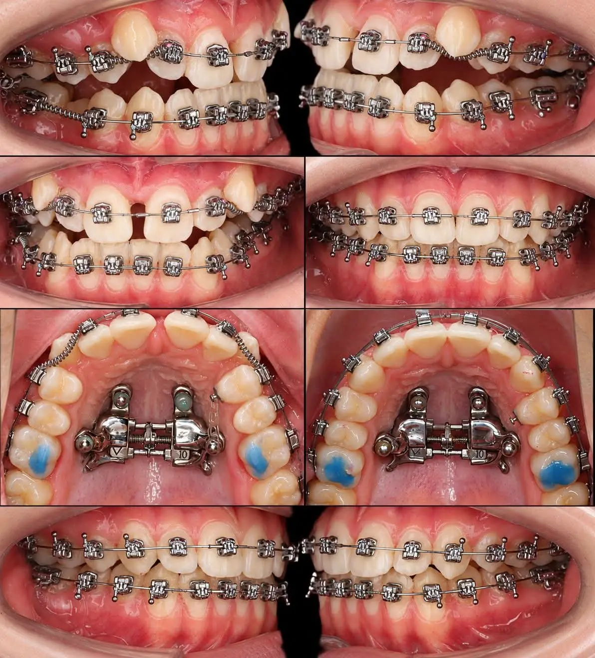 BEAUTY OR MADNESS?
Can you go for this ?
Check my reply at comment section
Also drop yours
