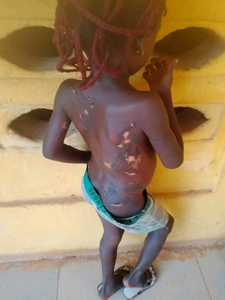 Some people are just demons in flesh.
Mother arrested in Anambra for using hot knife on 7-year-old...