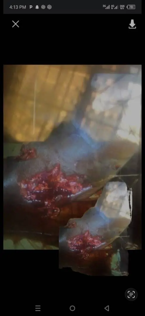 This man was shot in the leg, he needs justice