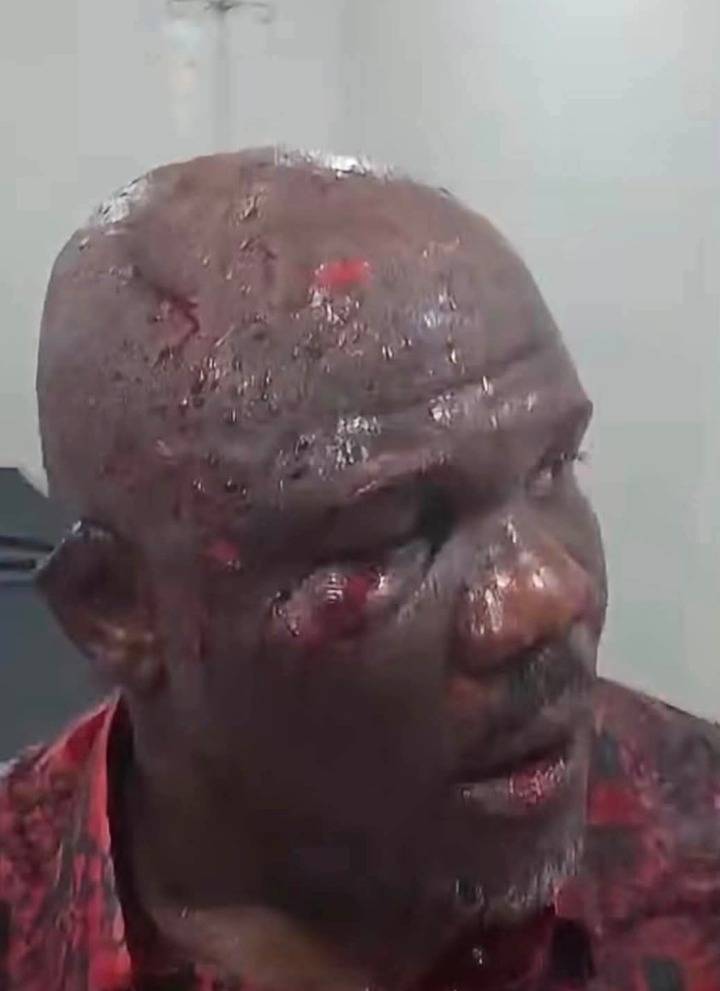 This is Mr. Tempo Mudi, Protocol Officer to the Delta State Governor. He was seriously beaten and in...