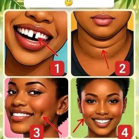 Which of this do you have🤔
Me; 1 and 4