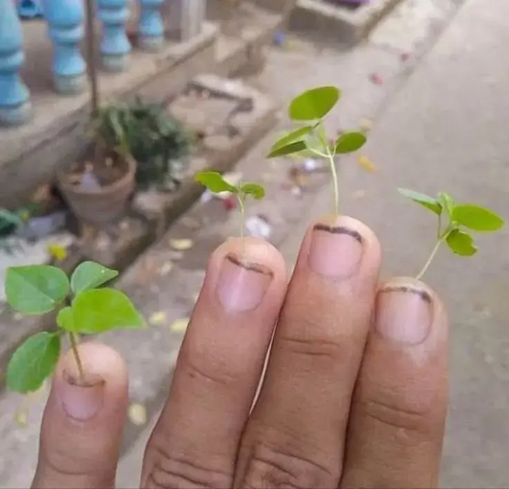 Pls try to clean your nails always
Because we have to maintain good hygiene
#LekeeLekee
#Viral
#...