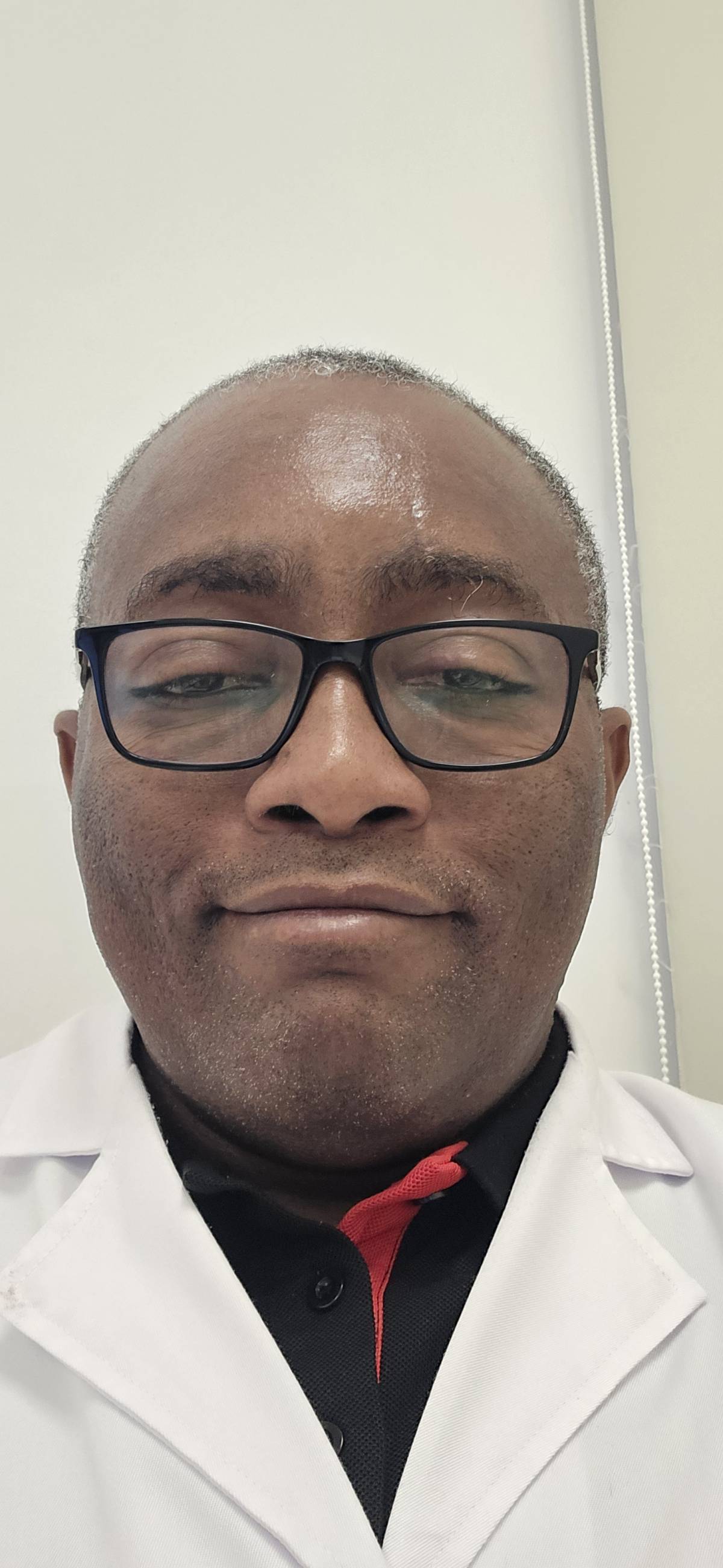 Sickle cell disorder can cause cavities (holes) in the teeth leading to dental decay.
I noticed hole...