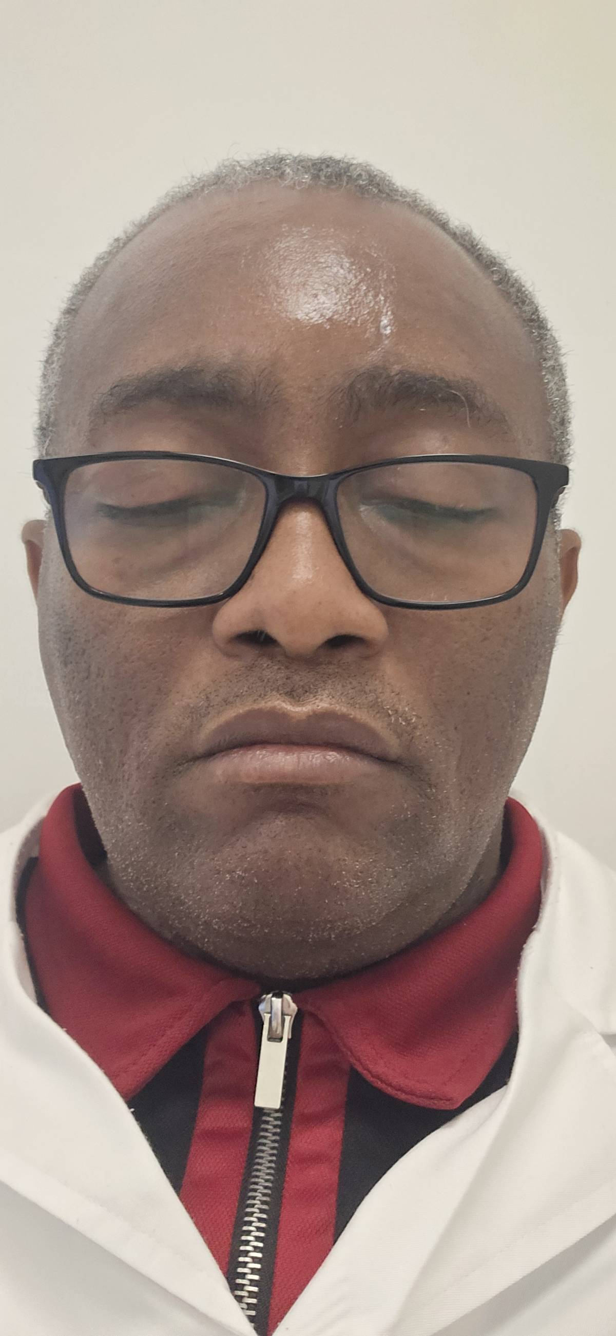 If you are a very optimistic person,
Sometimes, an episode of sickle cell pain crisis can ruin your...