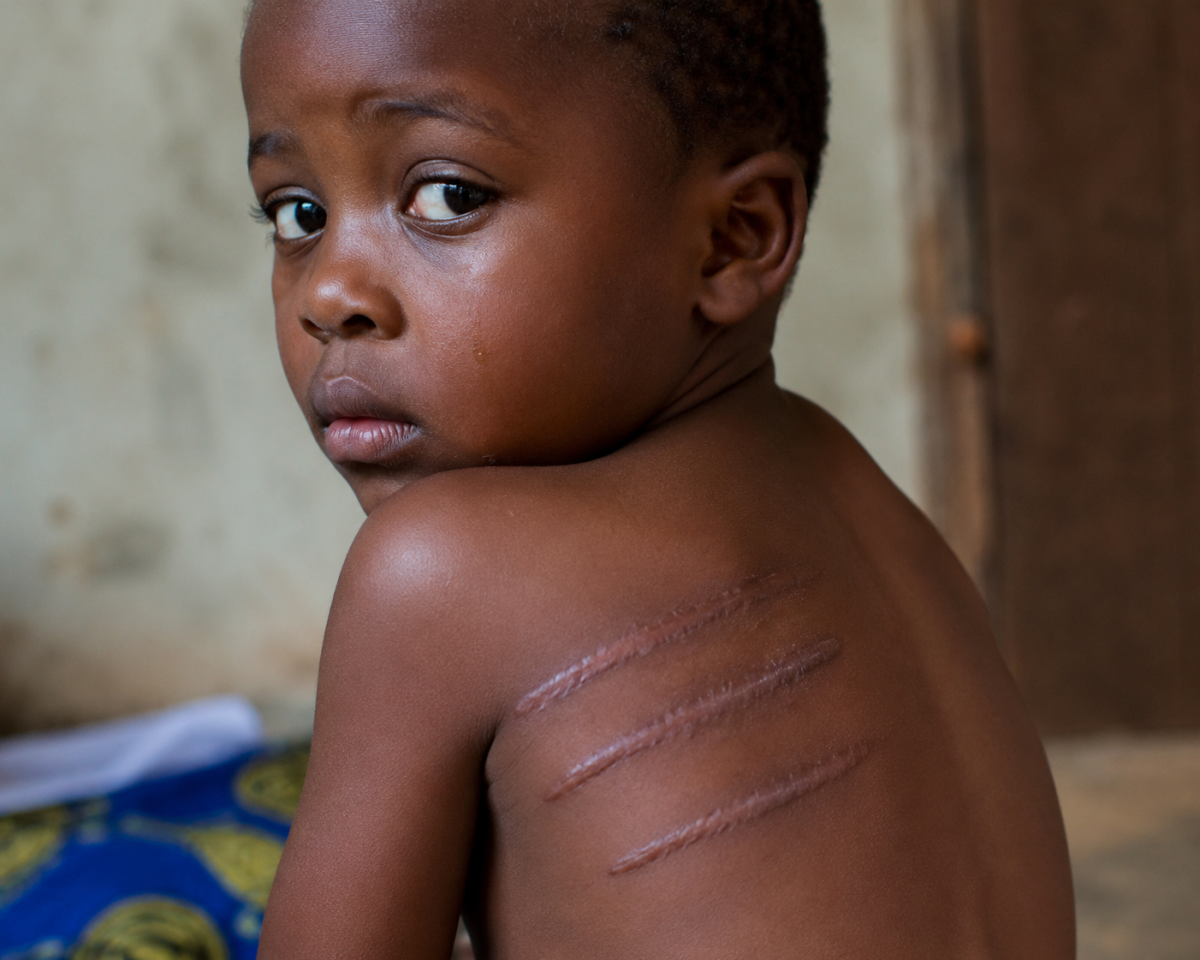 THE SCAR
Not every mark on a child’s body is discipline.
Some scars are pain that never truly heals...