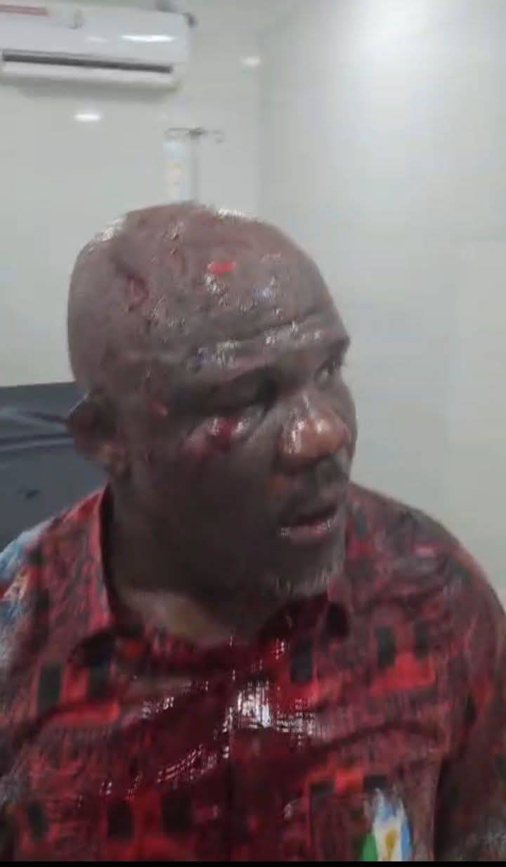 This is Mr. Tempo Mudi, Protocol Officer to the Delta State Governor. He was seriously beaten and in...
