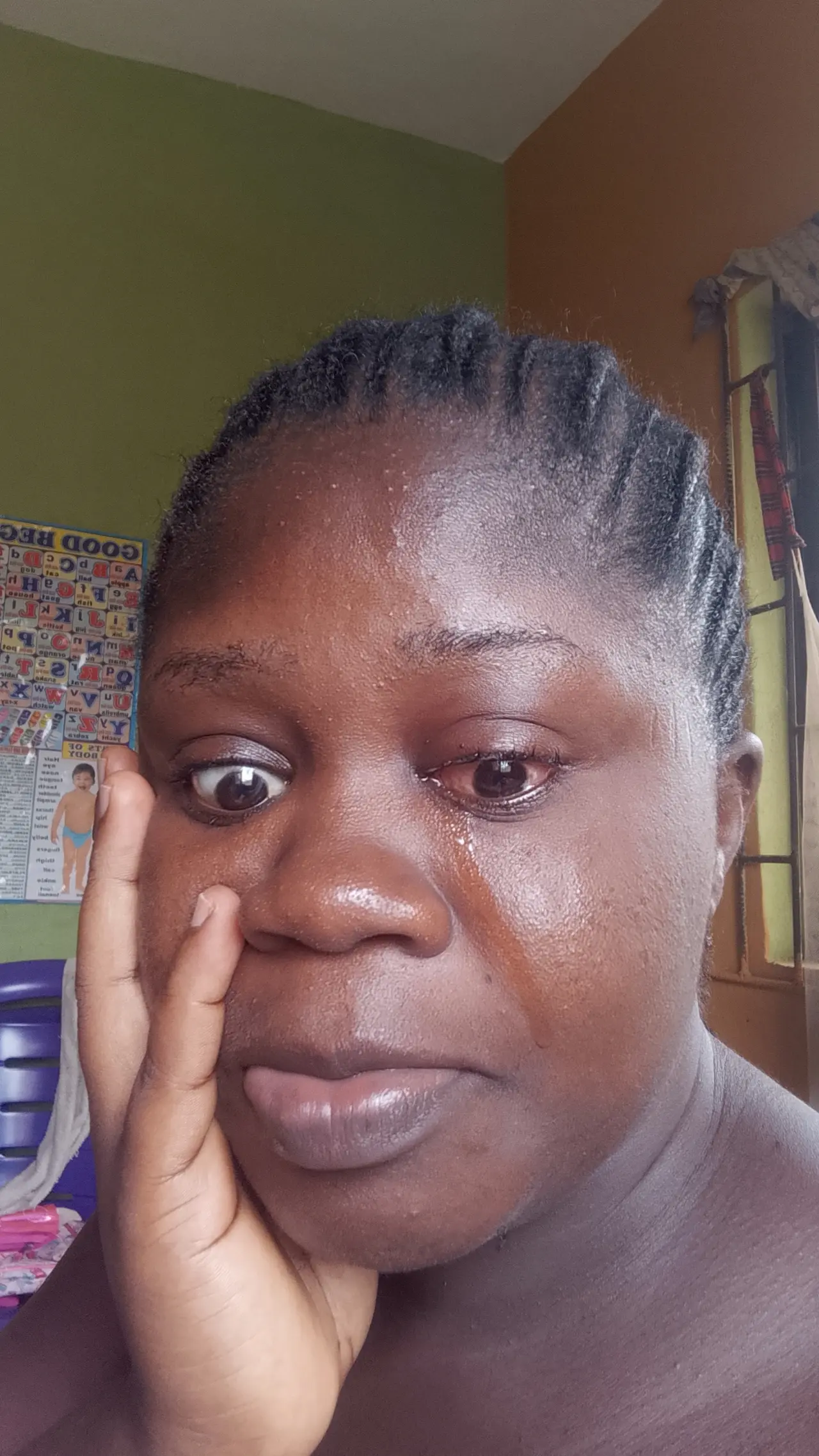 Only me against the world
After treatment i became fine
I was happy that at i can eat and no more...
