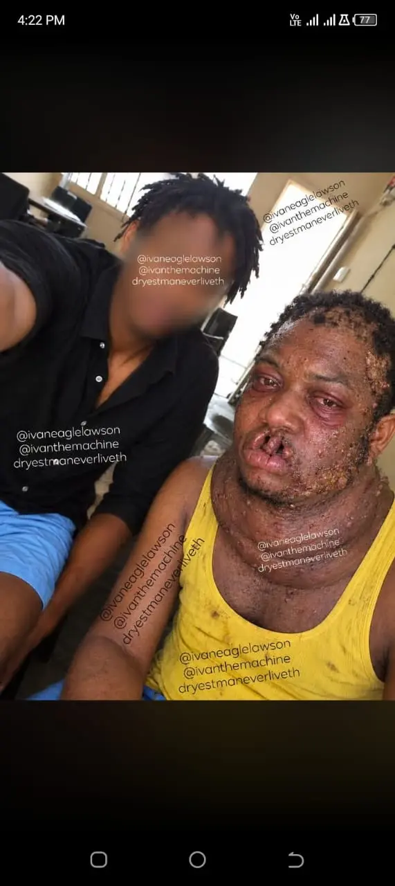 The man you see in the photo is 47 year old Simeon Okoh who lives in Nuhu boulevard in Kabusa Garden...