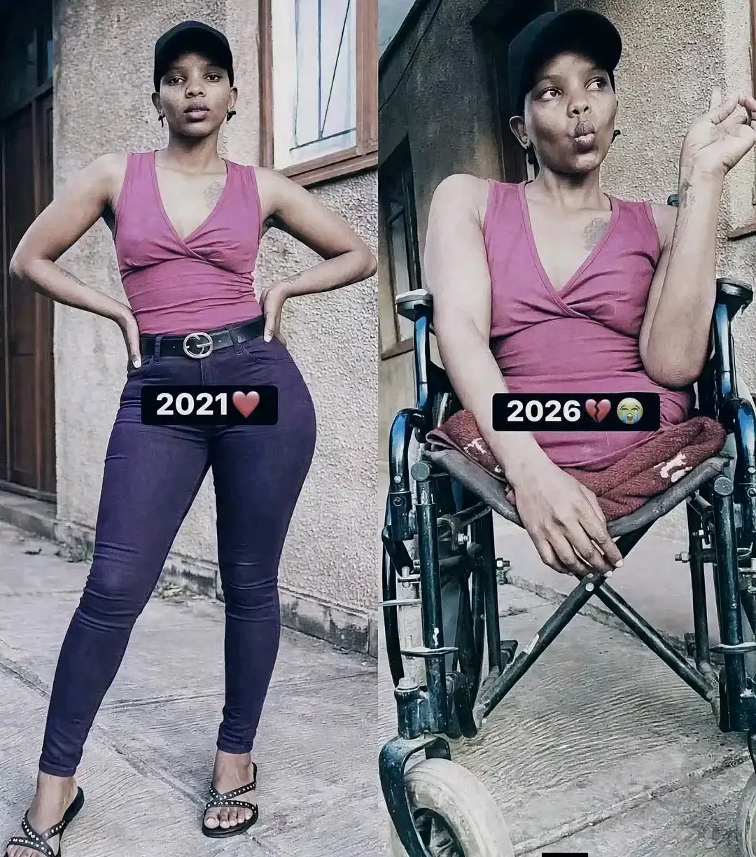 She lost her two leg in accident ππ
Pls donβt go without saying sorry π