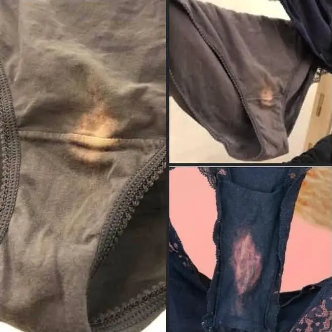 Dear women❗️
Why’s your Discharge bleaching your panties?
Is it normal or should you be worried?
Do...