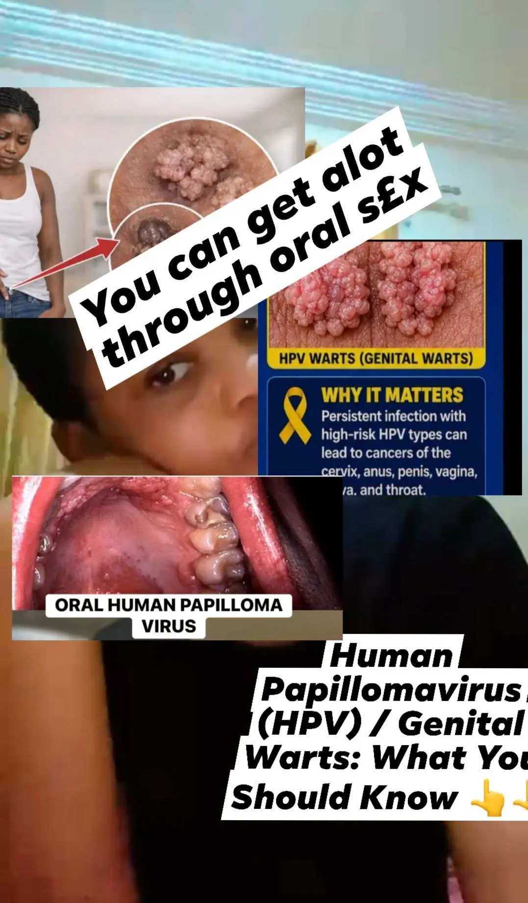 HUMAN PAPILLOMA VIRUS (HPV) / GENITAL WARTS: WHAT YOU SHOULD KNOW 👇👇
HPV (Human Papillomavirus) i...