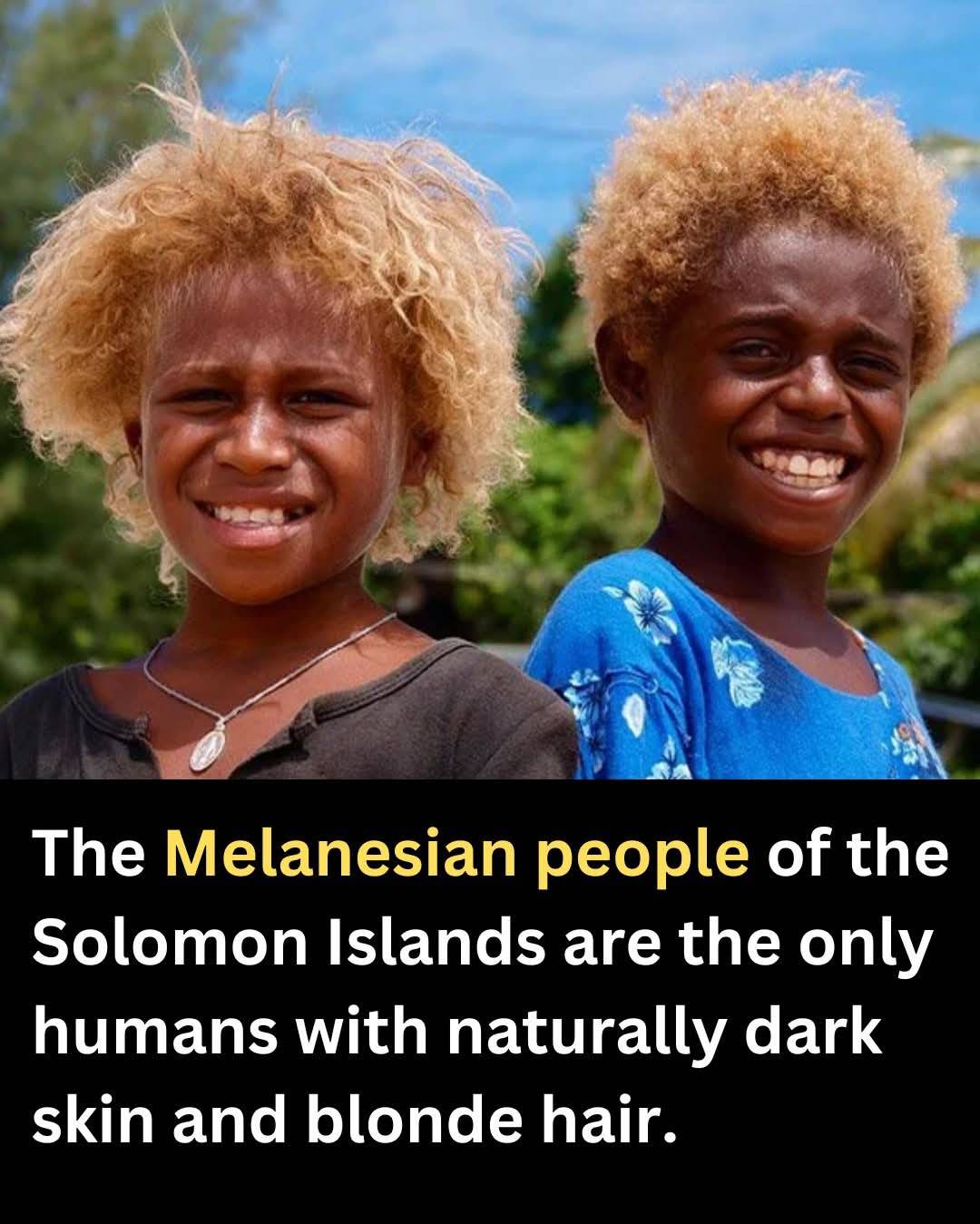 The Melanesian people of the Solomon Islands are the only known human population with both naturally...