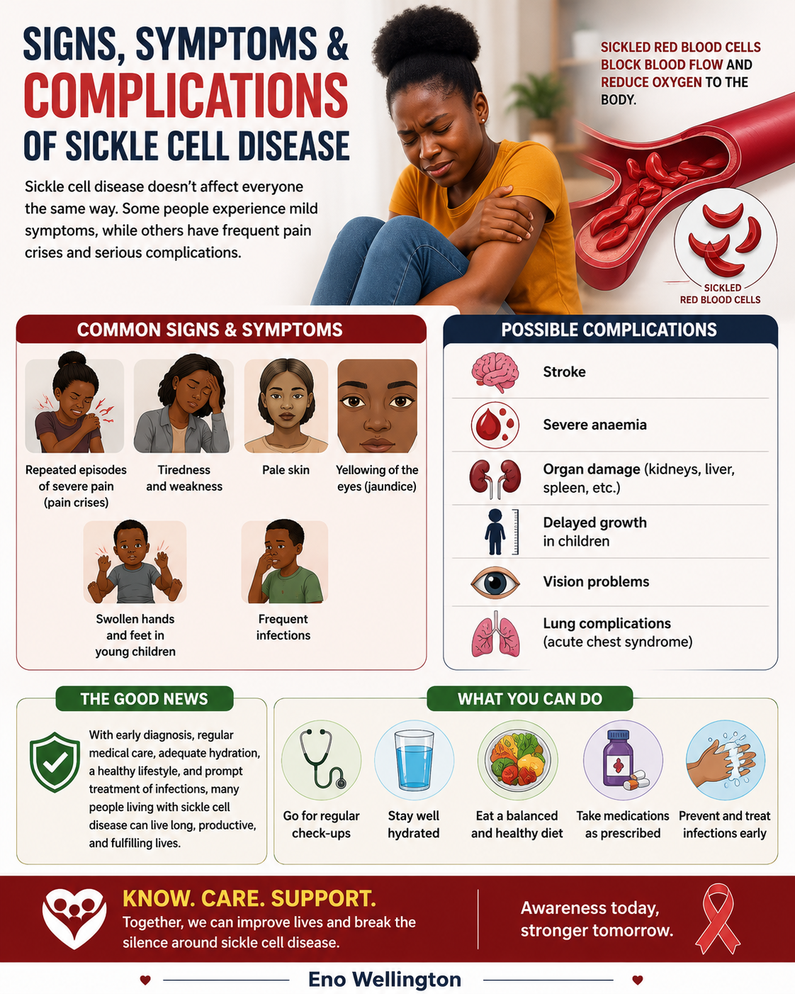 Signs, Symptoms & Complications of Sickle Cell Disease
Sickle cell disease doesn't affect everyone...