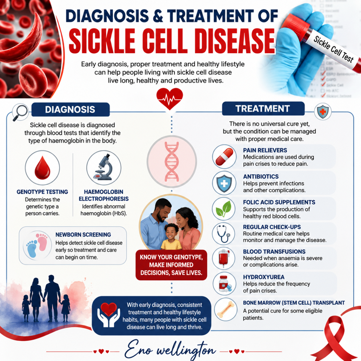 Diagnosis & Treatment of Sickle Cell Disease
Early diagnosis of sickle cell disease is essential fo...